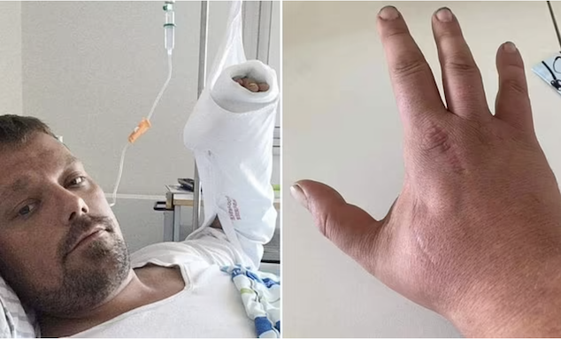 Macskaharapás belehalt egy dán férfi