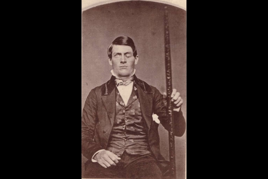 Phineas P. Gage