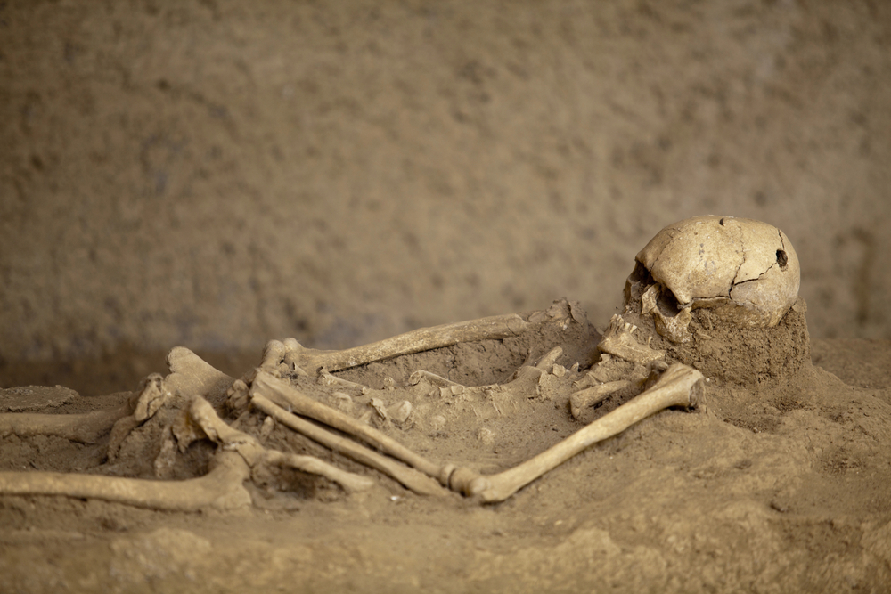 trepanáció
